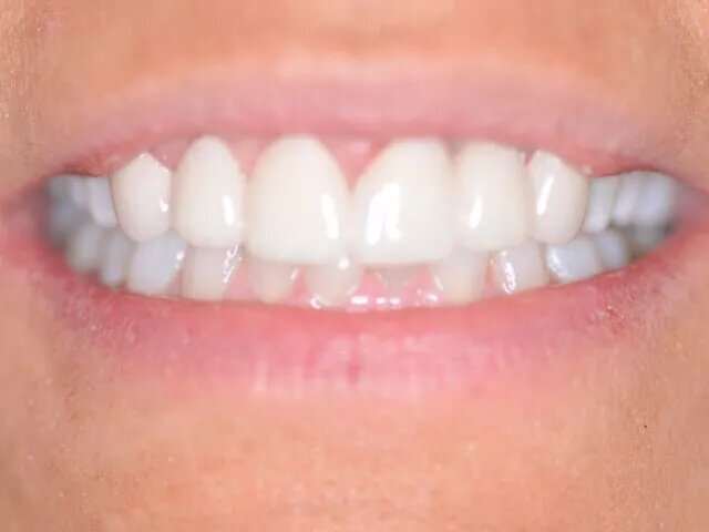 Manson Dental Manson Dental