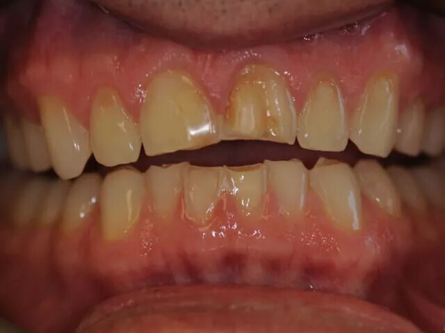 Manson Dental Manson Dental