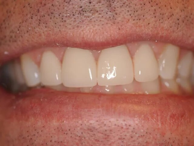 Manson Dental Manson Dental