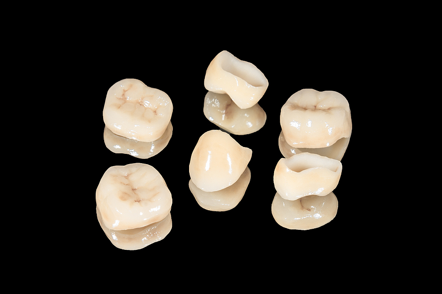 image for Dental Crowns