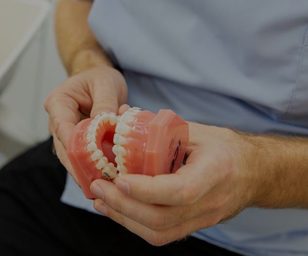 image for Dentures image for Dentures