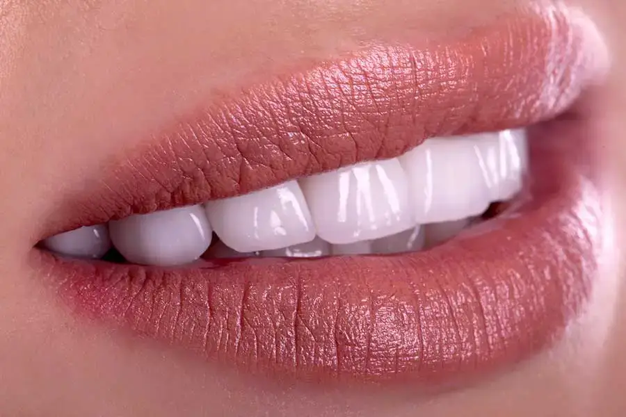 image for Teeth Whitening Treatments image for Teeth Whitening Treatments